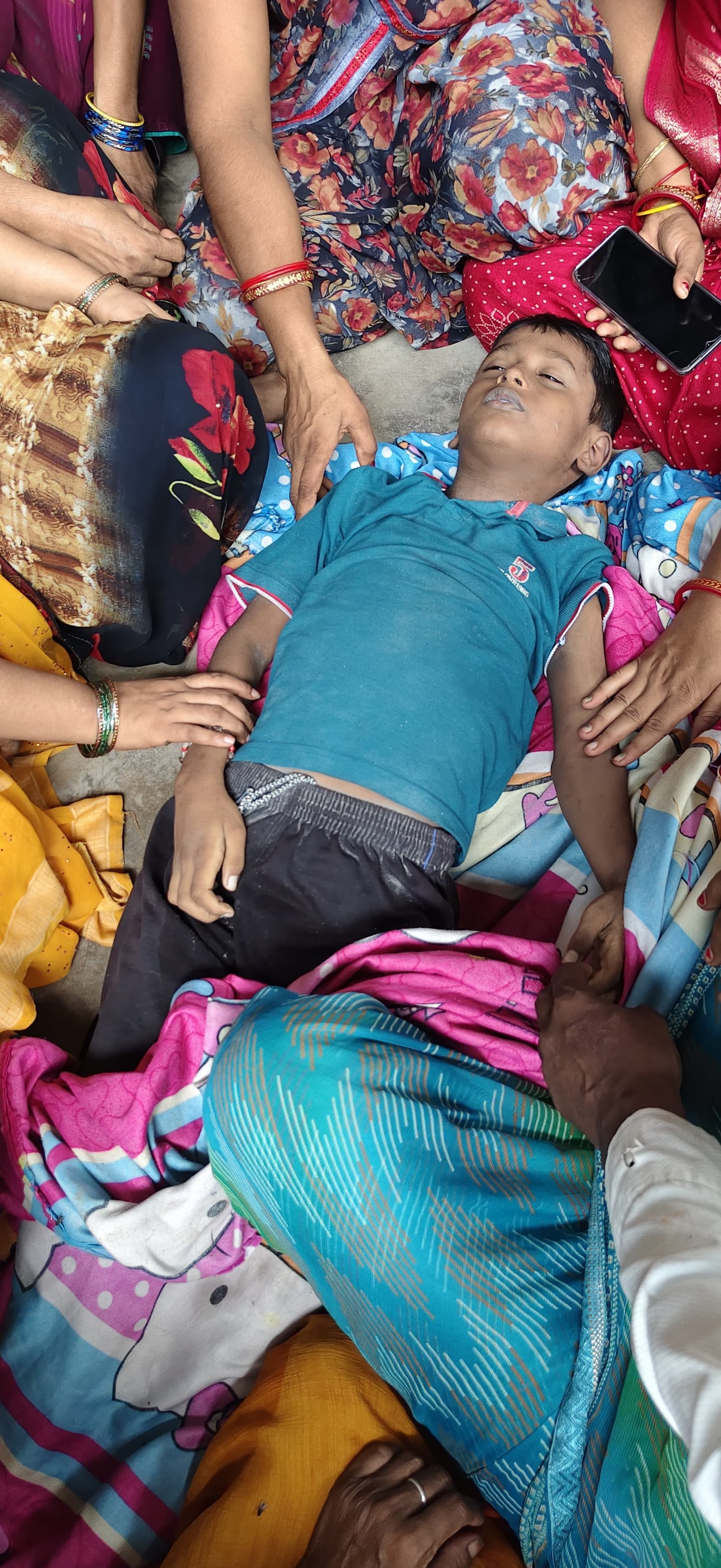 सर्पदंश से मासूम की मौत समय पर उपचार और जागरूकता से बचाई जा सकती है अनमोल जान