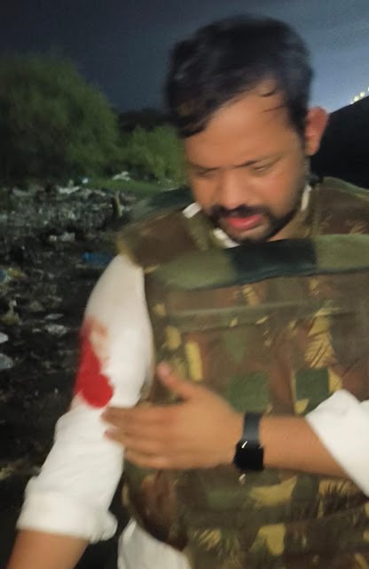 चांदी लूटकांड के दो बदमाशों के पैरों में लगी गोली, एसओजी प्रभारी गौरव कुमार सिंह भी घायल